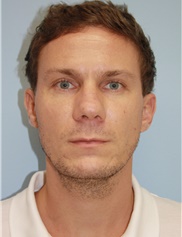 Philipp Hüttinger, MD
